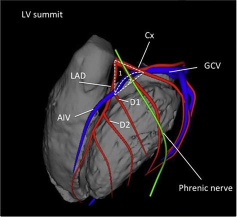 lv summit anatomy.